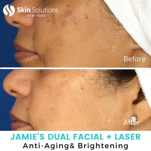 Anti Aging Skin Care and Skin Rejuvenation Treatment