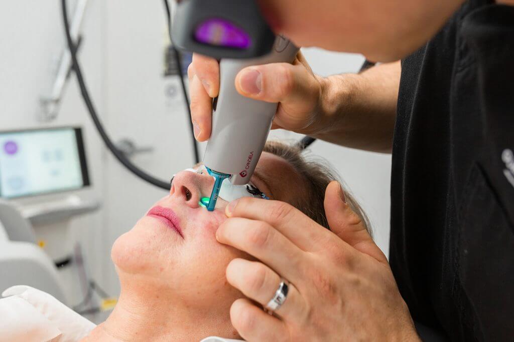 The Science Behind Vbeam Laser Treatment: How It Works and What to Expect