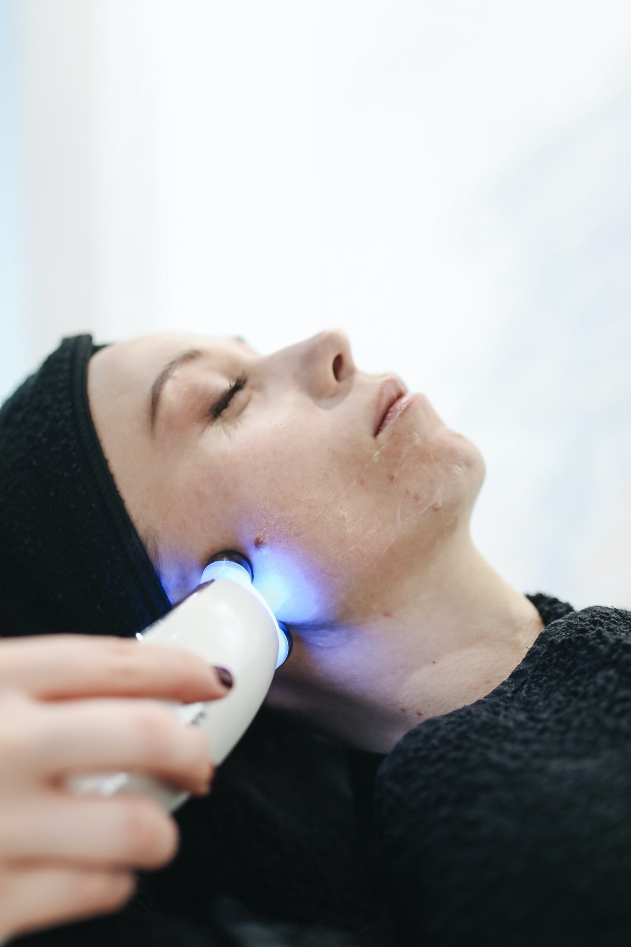 HydraFacial for Anti Aging and Acne Treatment