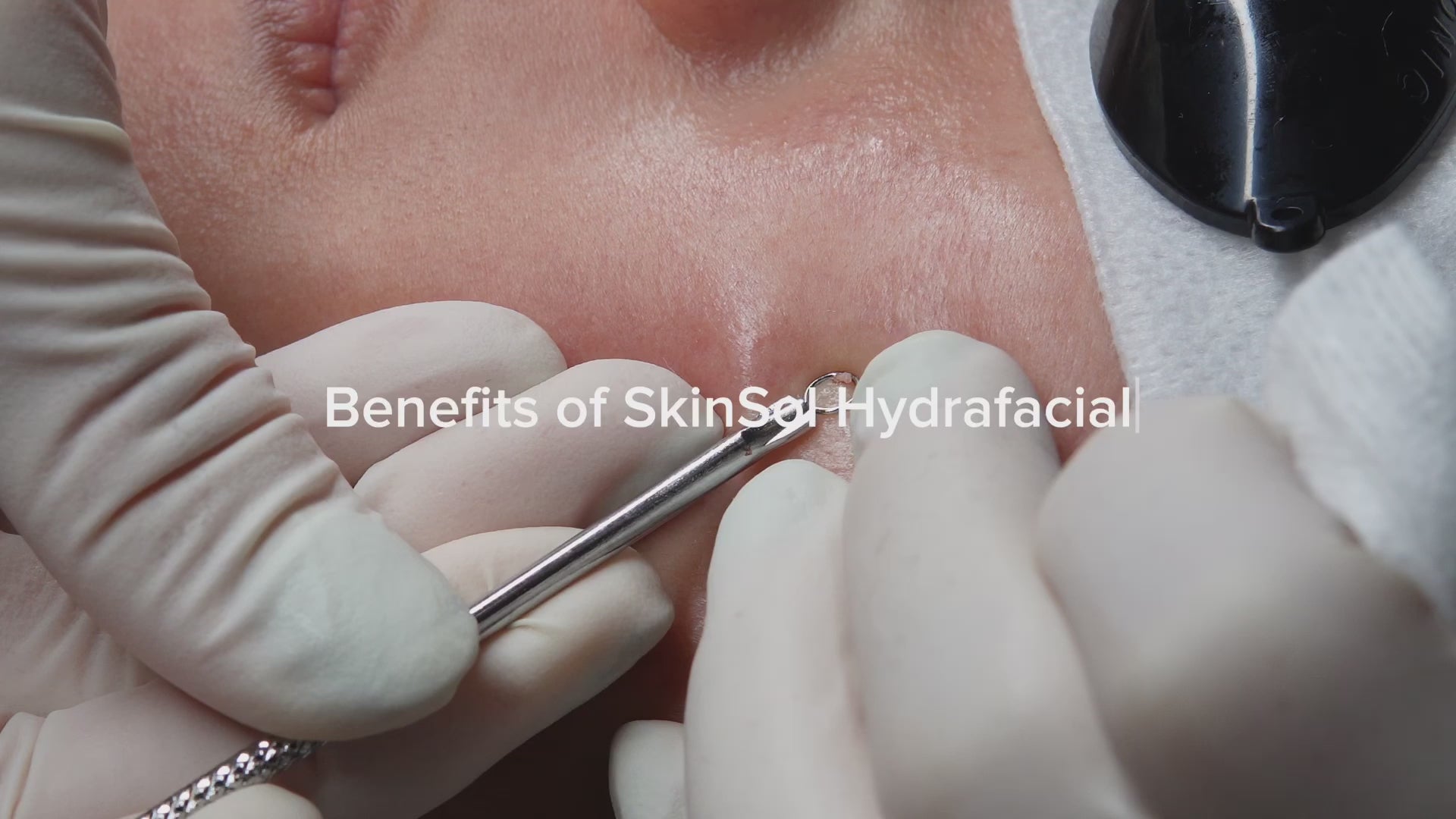 Hidrafacial SkinSol™-3